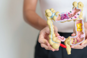 healthy colon diet foods